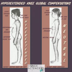 global compensations in knee hyperextension