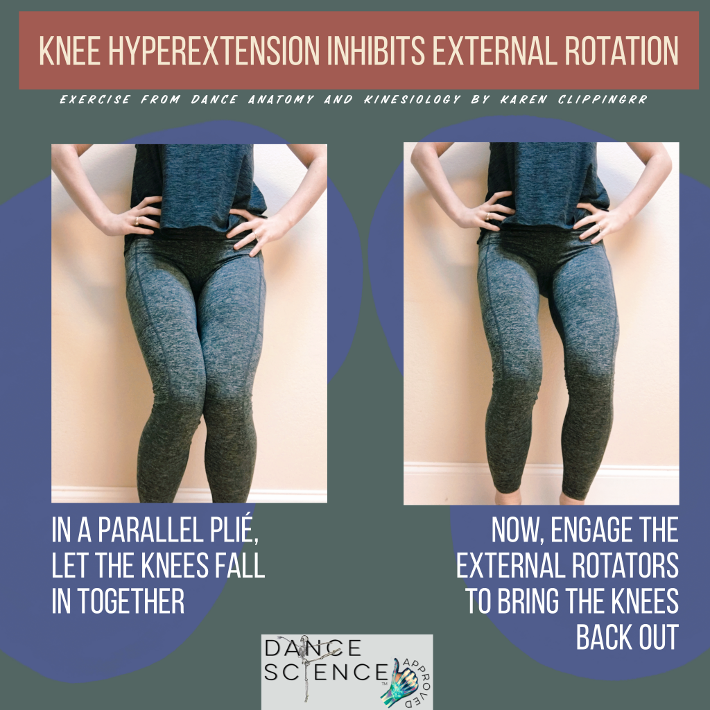 Knee hyperextension inhibits external rotation 